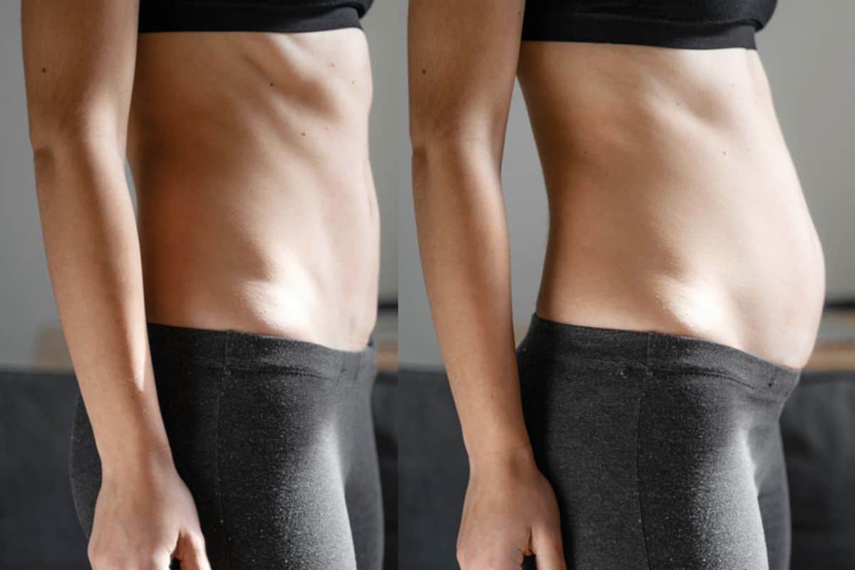 How long does diastasis recti take to improve Lincolnshire?