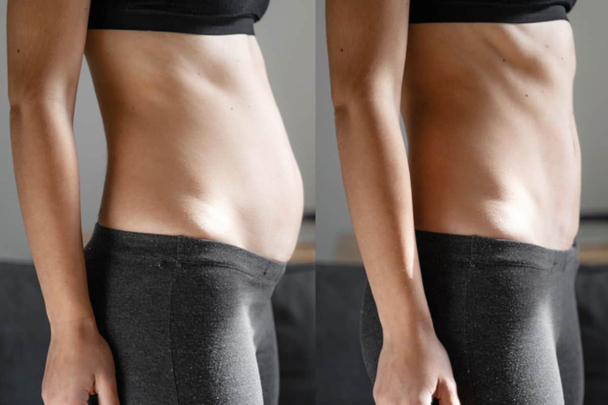 Post-Pregnancy: What Happens to Your Abdominal Muscles After Birth Lincolnshire