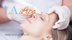 Woman receiving Actinic Keratosis Removal Treatment Lincolnshire