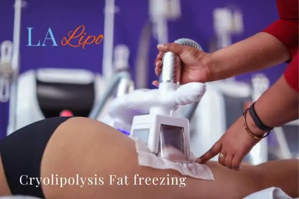 women getting fat freezing Lincolnshire