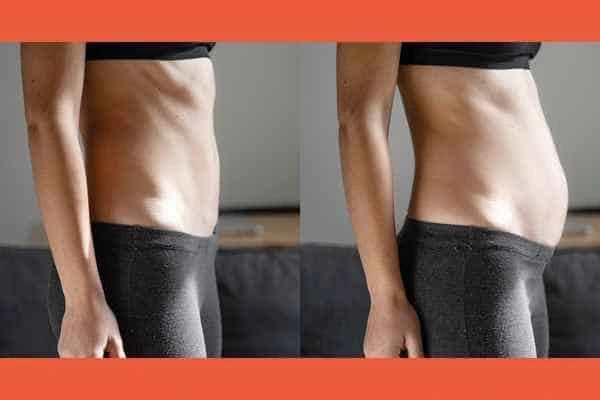 LA-EMS Body Sculpting results Lincolnshire