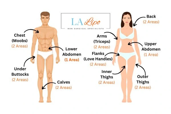 LA LIPO Cryolipolysis Areas Lincolnshire
