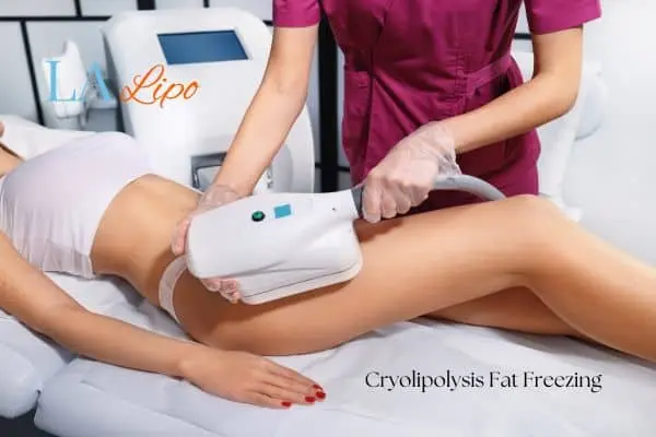 Woman receiving coolsculpting Lincolnshire treatment on her thighs