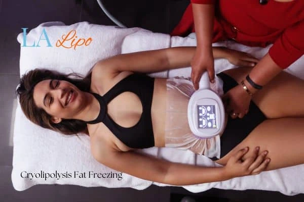 woman getting cryolipolysis Lincolnshire