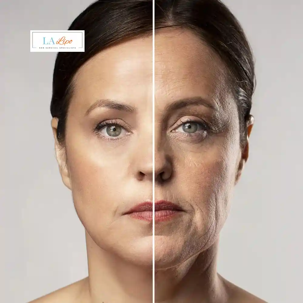 How Can You Tell If Non-Surgical Skin Tightening Is Right for You Lincolnshire?