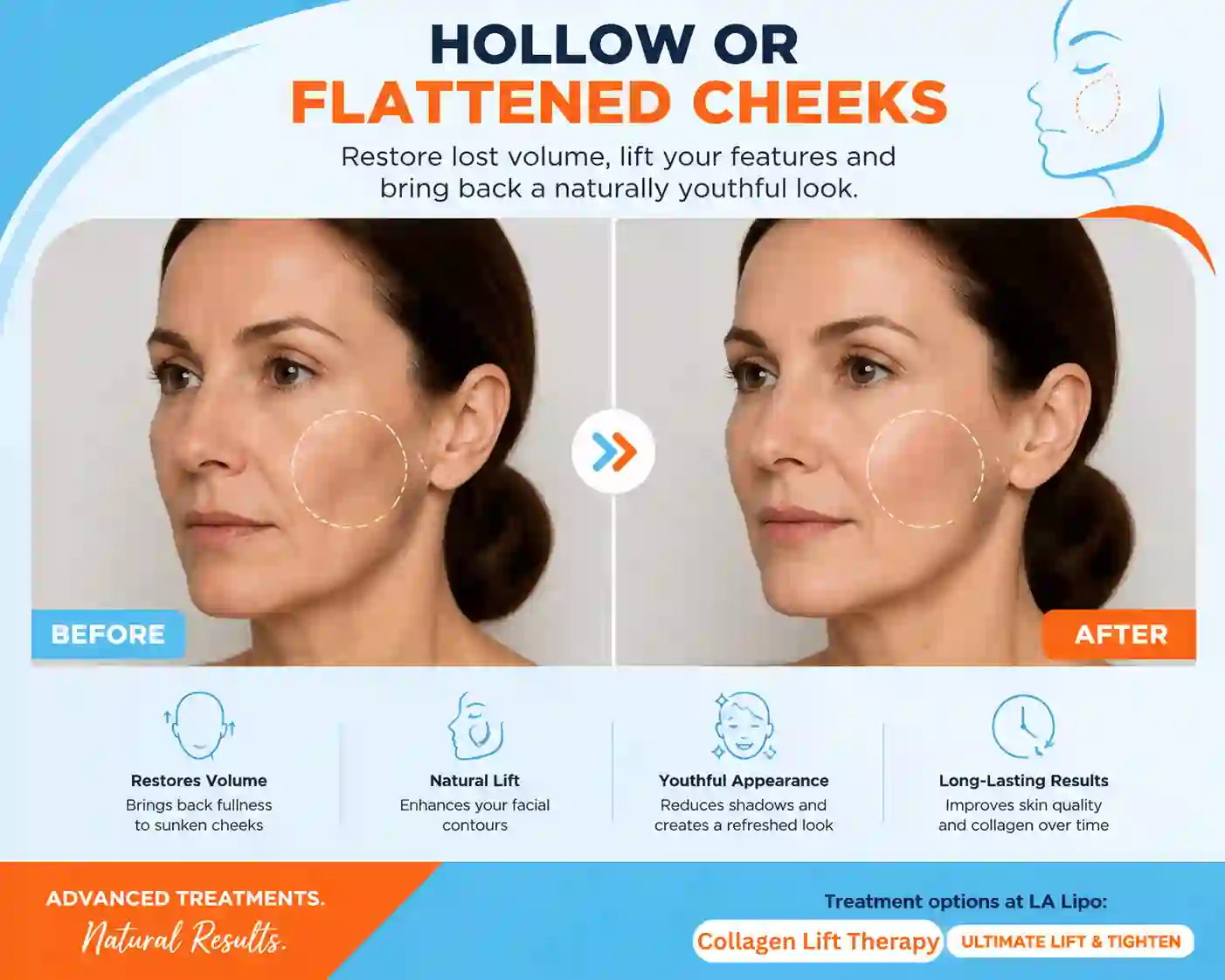 Sign #4: Hollow or Flattened Cheeks Lincolnshire