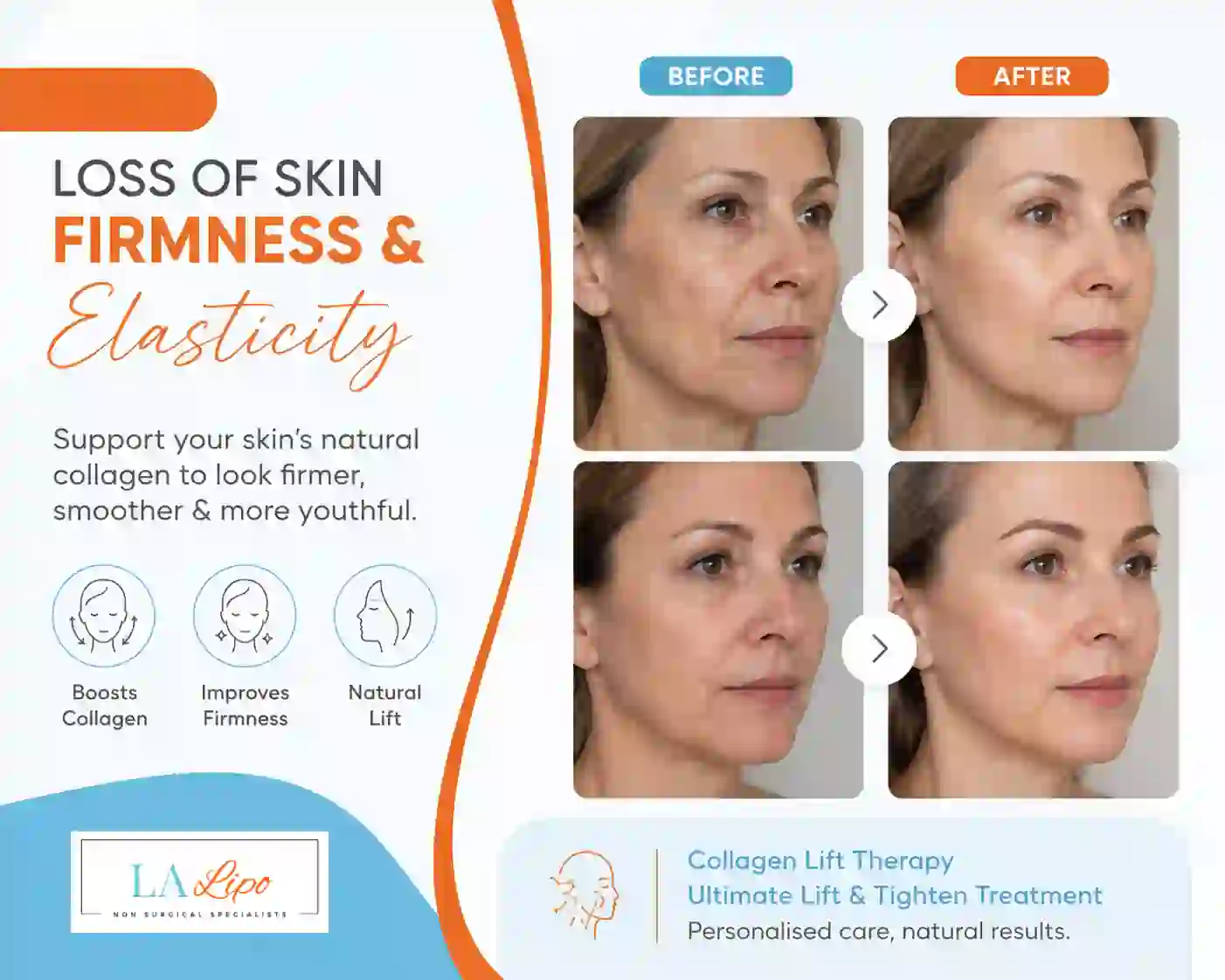 Sign #7: Loss of Skin Firmness and Elasticity Lincolnshire